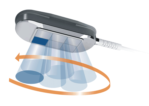 Handsfreesono; Ultraschalltherapie Handsfreesono; Ultraschalltherapie